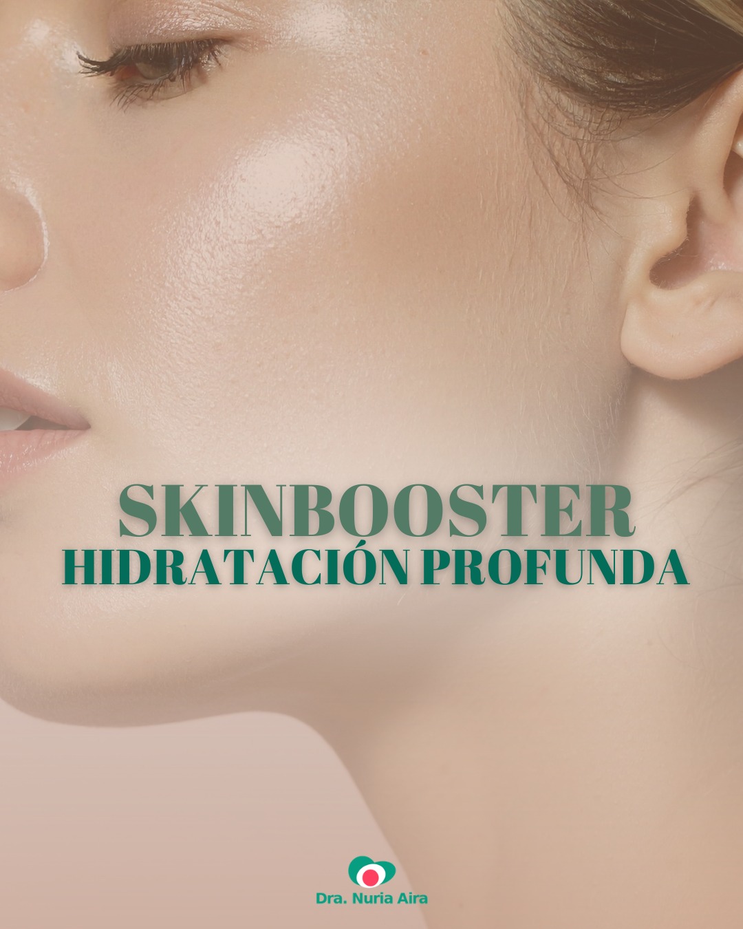 Skinbooster: hidratación profunda y luminosidad para tu piel ✨

Los Skinboosters son uno de los tratamientos más demandados en medicina estética gracias a su capacidad para mejorar la calidad de la piel desde el interior.

Este tratamiento ayuda a hidratar, revitalizar y mejorar la elasticidad de la piel, consiguiendo un aspecto más fresco, terso y luminoso.

En Dra. Nuria Aira realizamos una valoración personalizada para adaptar el tratamiento a las necesidades de cada piel y conseguir resultados naturales y progresivos 💚

#skinbooster #acidohialuronico #hidratacionfacial #medicinaestetica #rejuvenecimientofacial