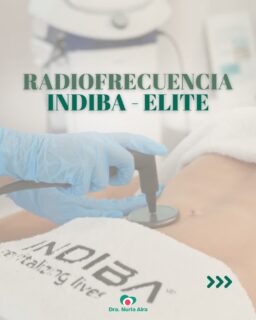 INDIBA® Elite es la radiofrecuencia médica que ayuda a rejuvenecer, remodelar y regenerar los tejidos de forma natural. 

Un tratamiento no invasivo que mejora la calidad de la piel, estimula la producción de colágeno y combate la flacidez y la celulitis con resultados visibles y progresivos.

Reserva tu valoración personalizada y descubre todo lo que INDIBA® Elite puede hacer por ti.

#INDIBA #INDIBAElite #RadiofrecuenciaINDIBA #MedicinaEstética #DraNuriaAira #RejuvenecimientoFacial #RemodelaciónCorporal #Celulitis
